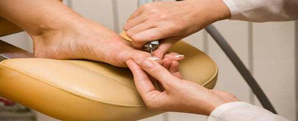 Removing Your Nail to Treat Nail Fungus